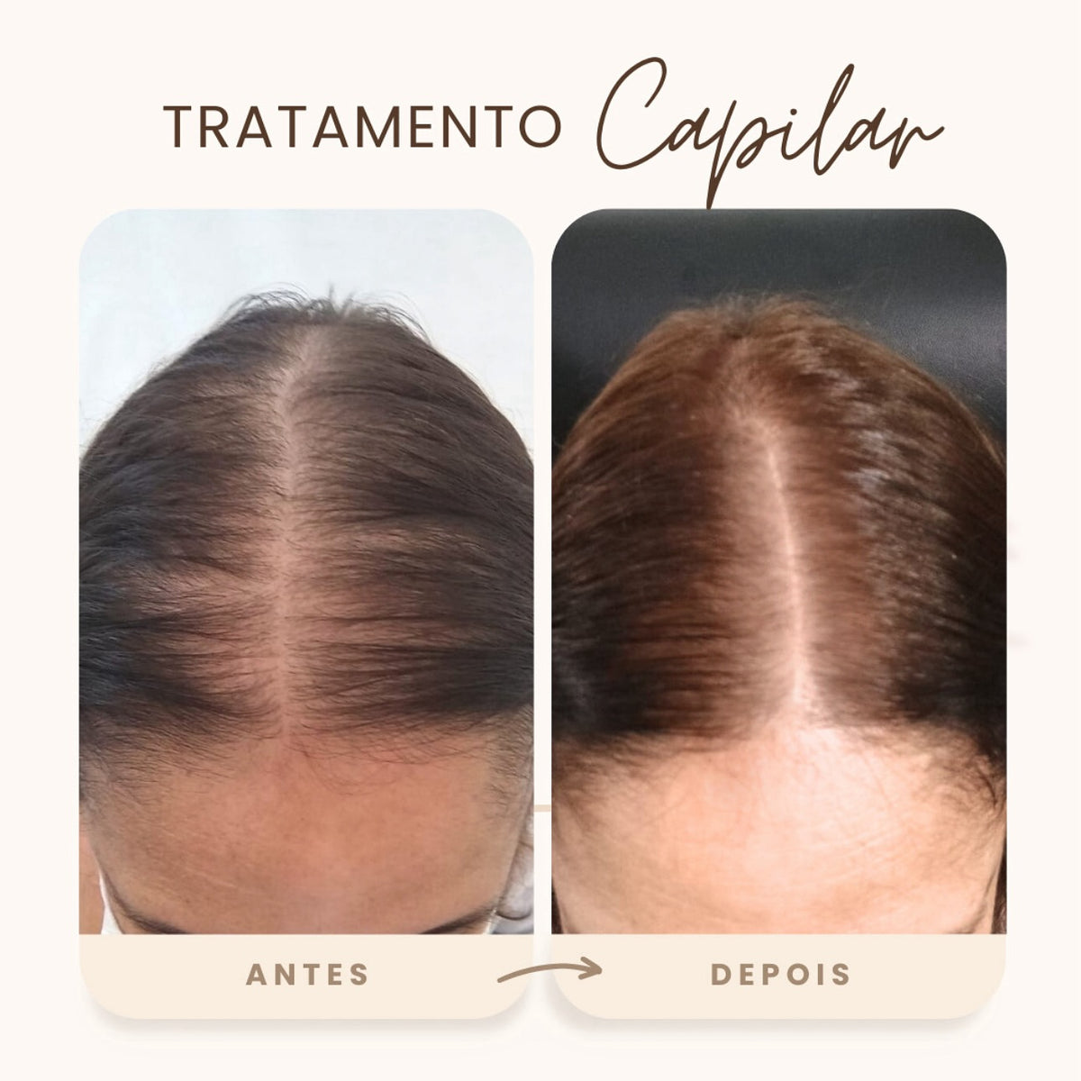 Hair Growth